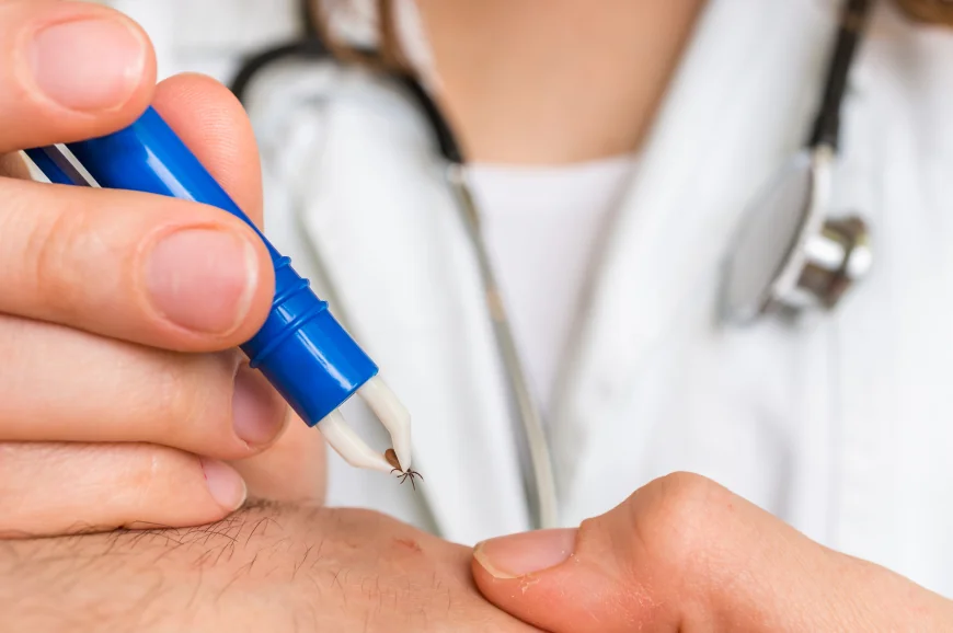 Cum scoți corect o căpușă și când trebuie să mergi la medic. Avertismentul specialiștilor: „Nu se folosesc substanțe pe piele”