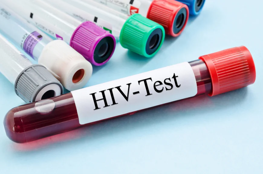 Cercetătorii australieni, „uluiți” de efectele unui nou tratament contra HIV. Descoperirea care ar putea duce la eradicarea virusului