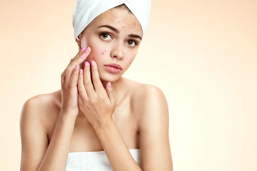 Avertisment privind bolile de piele la adoloscenți. Rutinele de skincare promovate pe TikTok sunt periculoase