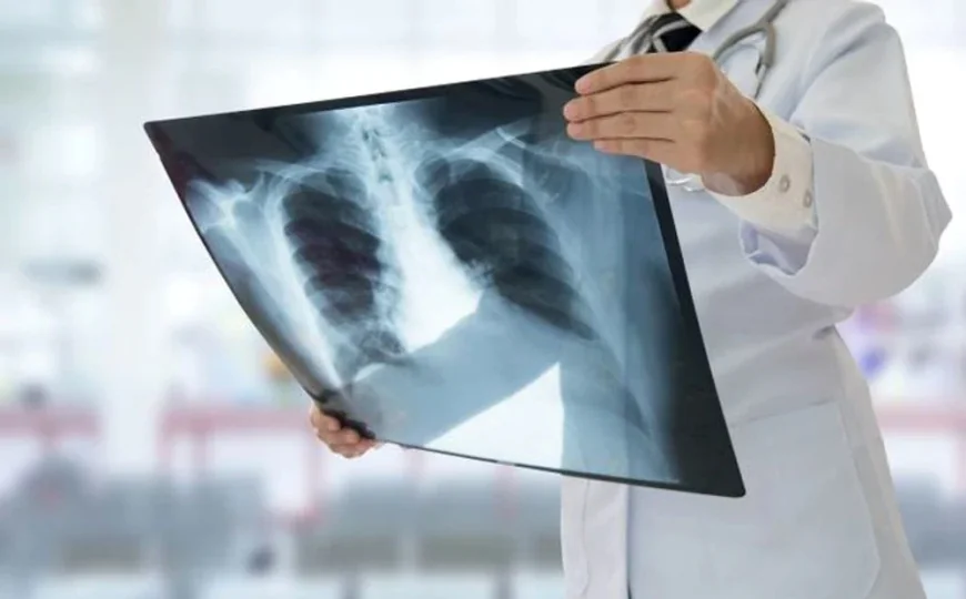 Simptomele ignorate ale cancerului de plămâni, boala de care suferă Ion Iliescu. „Nu are receptori de durere”